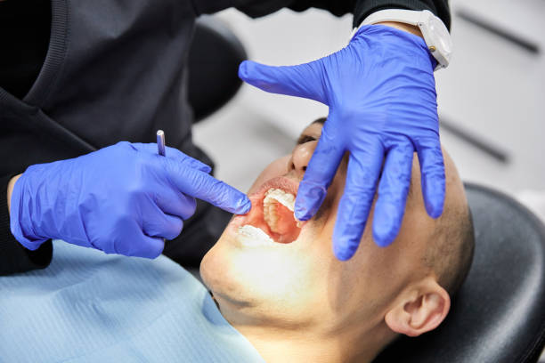 Best Emergency Wisdom Teeth Removal in Old Mystic, CT