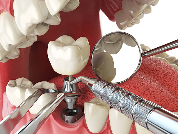 Best Emergency Denture Repair in Old Mystic, CT
